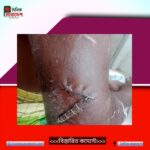 দোয়ারাবাজারে মসজিদ কমিটির কালেক্টরকে কুপিয়ে হাত কাটার চেষ্টা, দোষীদের গ্রেফতারের দাবিতে এলাকাবাসীর মানববন্ধন 