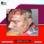 মোহনগঞ্জে গভীর নলকূপ স্থাপন নিয়ে হামলায় ২জন গুরতর আহত