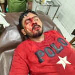 মারধরের প্রতিবাদে জবি শিক্ষার্থীদের সড়ক অবরোধ, পুলিশের লাঠিচার্জে আহত ২।